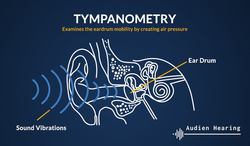 Infographic showing basics of tympanometry